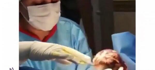 عکس ترسناک زایمان طبیعی خارجی بدون سانسور