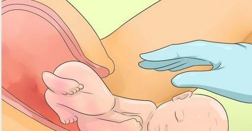 عکس زاییدن بچه طبیعی