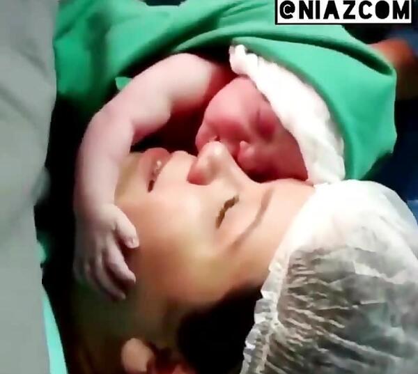 عکس بچه ی تازه به دنیا اومده