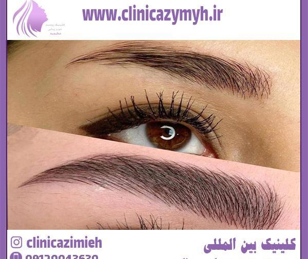 عکس تاتو ابرو میکروبلیدینگ