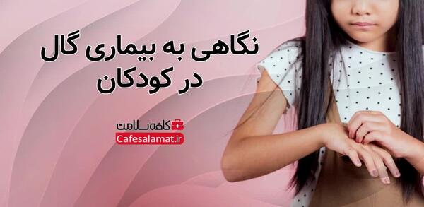 عکس بیماری گال در کودکان