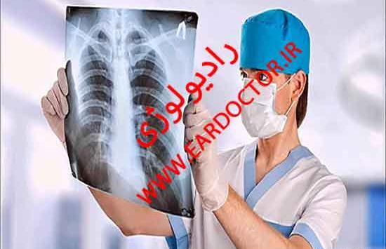 مشاهده عکس رادیولوژی بیمارستان امام علی چابهار