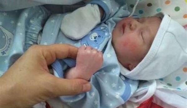 عکس بچه معلول