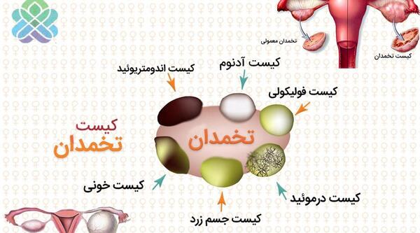 عکس بچه خوره در شکم مادر