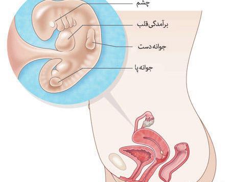 عکس بچه سقط شده دو ماهه