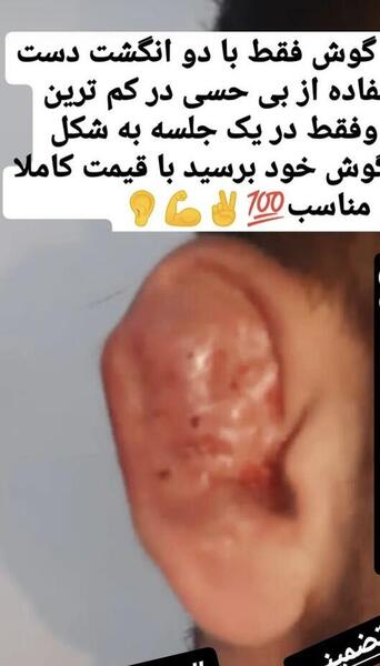عکس گل شکسته برای پروفایل