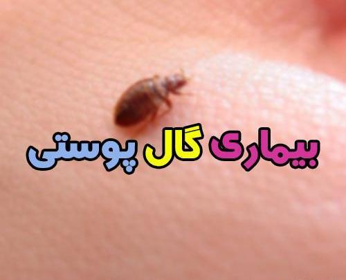 عکسهای از بیماری گال