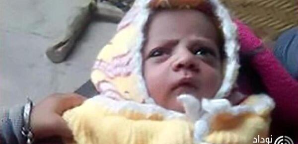 عکس بچه دزد وحشتناک