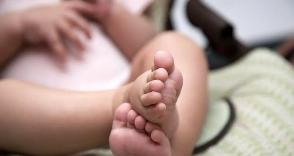 عکس بچه زشت ترسناک
