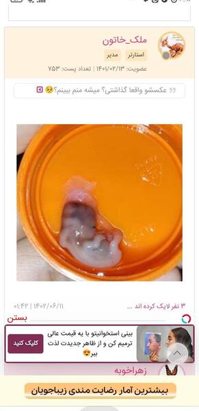 عکس بچه چهار ماهه سقط شده