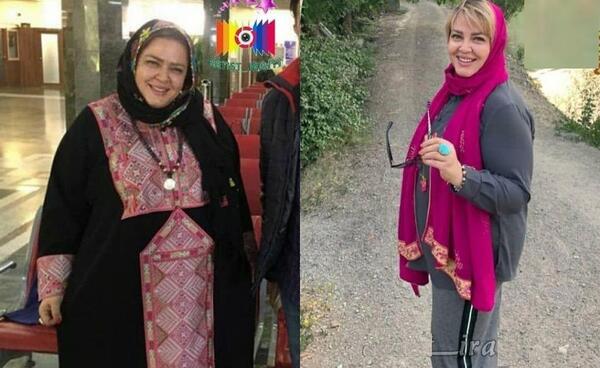 عکس چاقی و لاغری بهاره رهنما