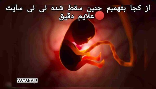 عکس بچه سقط شده نی نی سایت