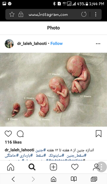 عکس بچه سقط شده نی نی سایت