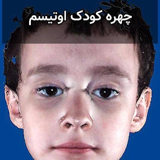 عکس بچه کوچک زشت