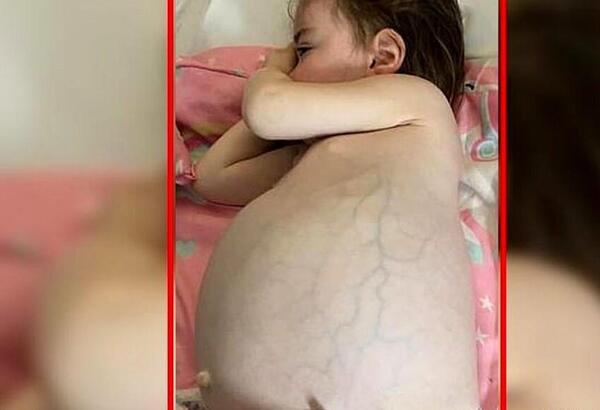 عکس بچه در شکم مادر واقعی
