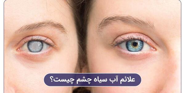 عکس چشمی که اب سیاه دارد
