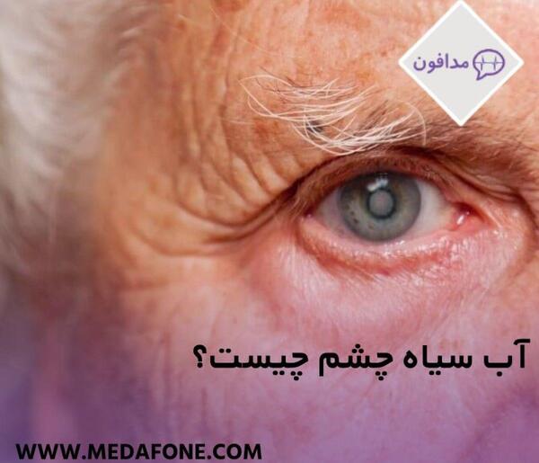 عکس چشمی که اب سیاه دارد