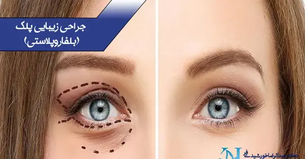 عکس برداری از چشم اهواز
