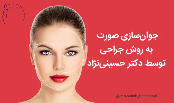 عکس برداری از چشم اهواز
