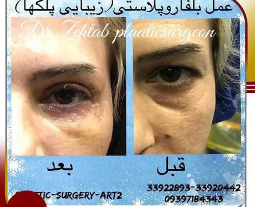 عکس برداری از چشم اهواز