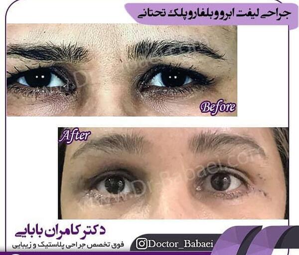 عکس برداری از چشم اهواز