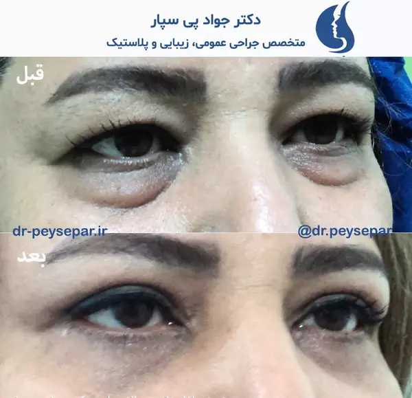 عکس برداری از چشم اهواز