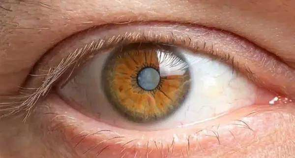 عکس چشم دارای اب سیاه