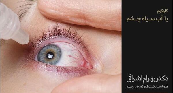 عکس چشم دارای اب سیاه
