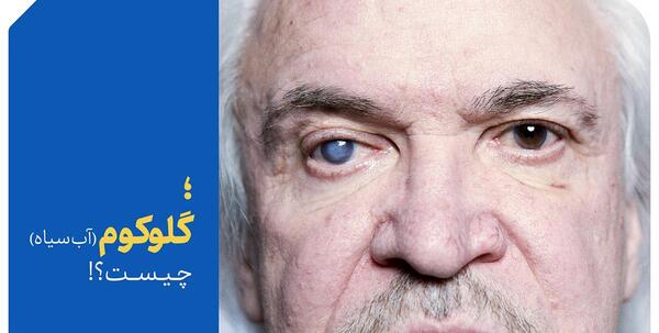 عکس چشم دارای اب سیاه