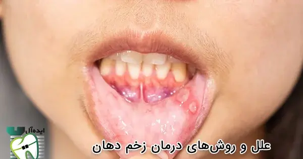 عکس هایی از سیاه زخم