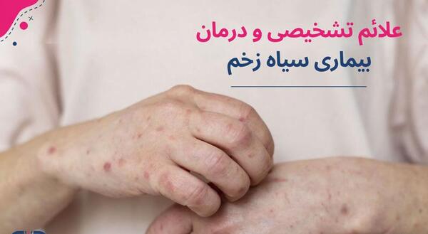 عکس هایی از سیاه زخم