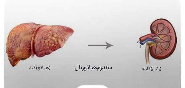 عکس سیاهرگ باب فوق کبدی