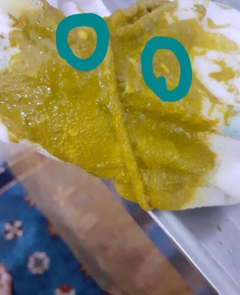 عکس مدفوع سیاه نوزاد
