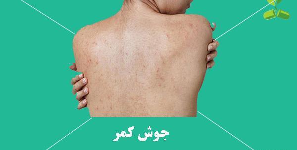 عکس لکه های کبدی