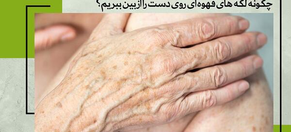 عکس لکه های کبدی