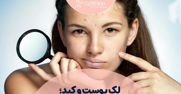 عکس لکه های کبدی