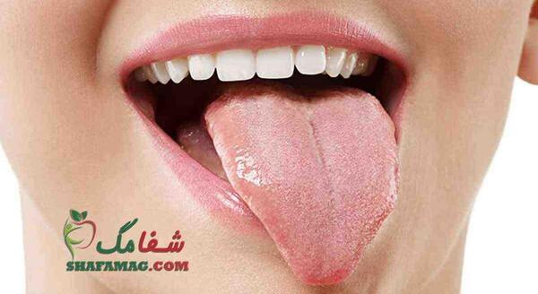 عکس لکه های کبدی