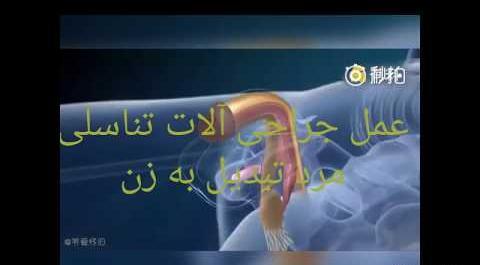 عکس های شکیب غلامی قبل از تغییر جنسیت