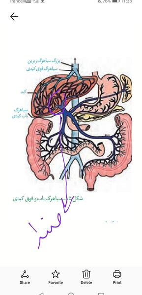 عکس سیاهرگ باب و فوق کبدی