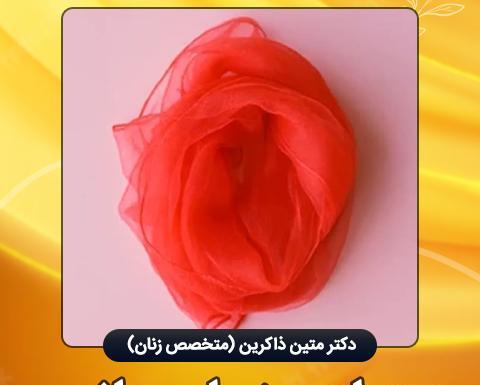 عکس های واقعی عمل لابیاپلاستی نی نی سایت