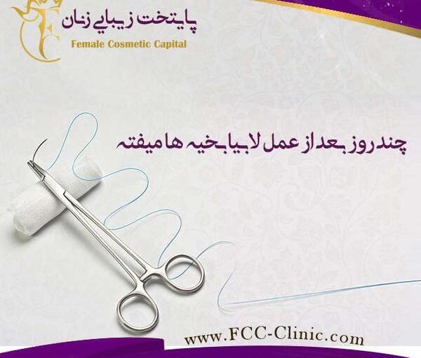 عکس های واقعی عمل لابیاپلاستی نی نی سایت
