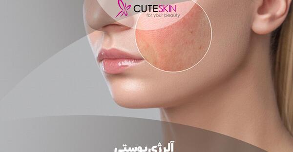 عکس حساسیت پوستی