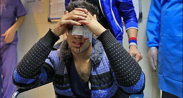 عکس های وحشتناک از چهارشنبه سوری