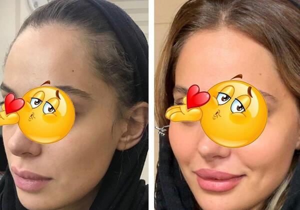 عکس های چاقی صورت