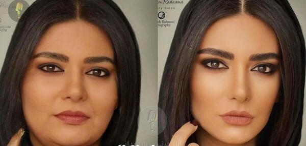 عکس های چاقی صورت