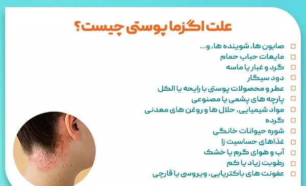 عکس انواع اگزما