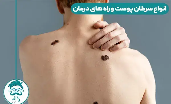 عکس ضایعه های پوستی