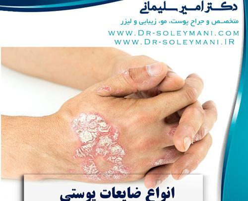 عکس ضایعه های پوستی