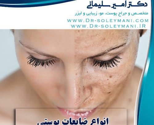 عکس ضایعه های پوستی