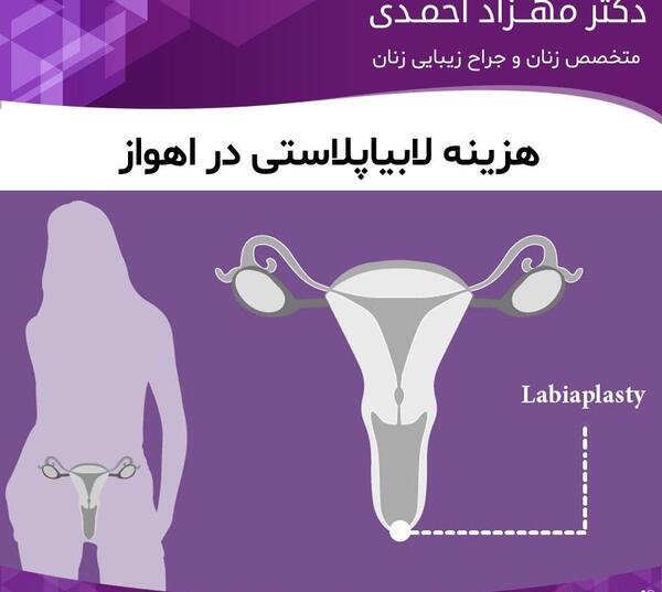 عکس های واقعی عمل لابیاپلاستی اهواز، استان خوزستان